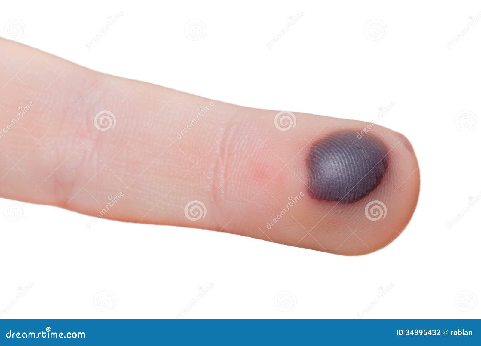 Bolla Di Sangue In Bocca Bolla di sangue fotografia stock. Immagine di crepe, rosso - 34995432