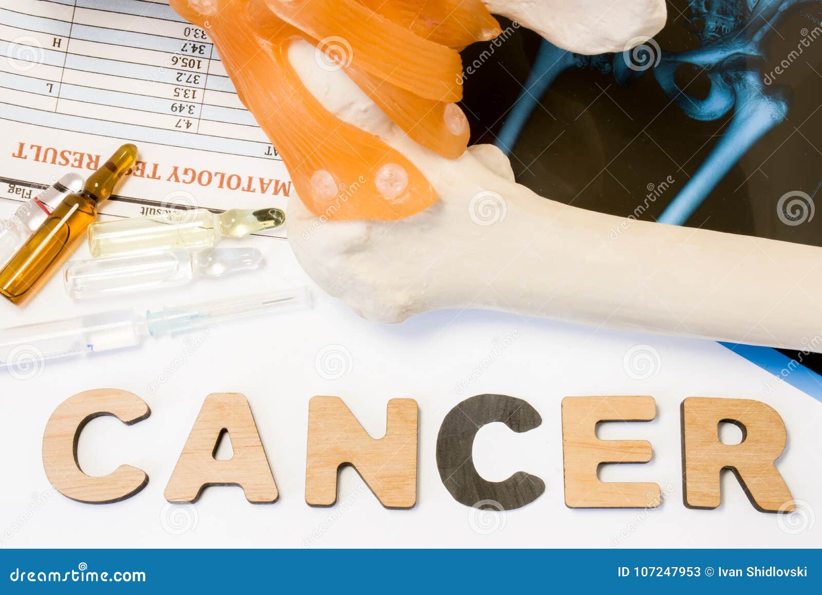 Brain Cancer Concept Anatomical Shape Of Brain Lies Near Word Cancer  Surrounded By Set Of Tests Analysis Drugs Mri Of Skull And Stethoscope  Diagnosis Treatment Of Brain Cancerous Tumors Stock Photo 