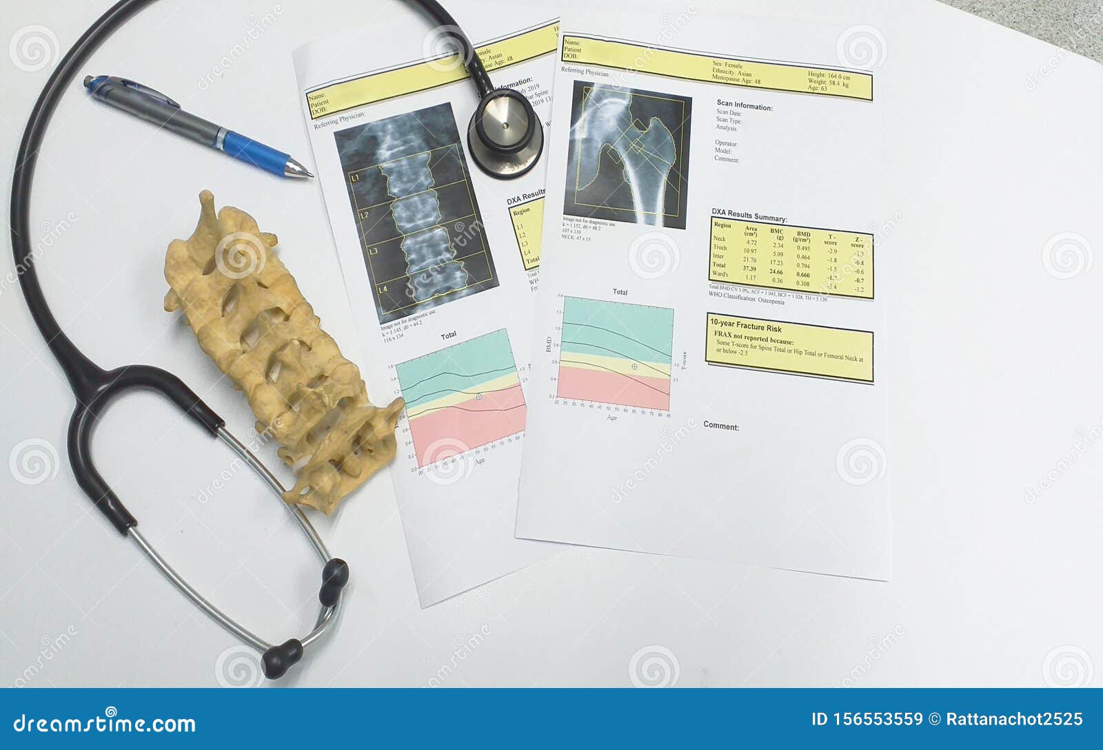 bone density hip and lumbarspine result osteoporosis