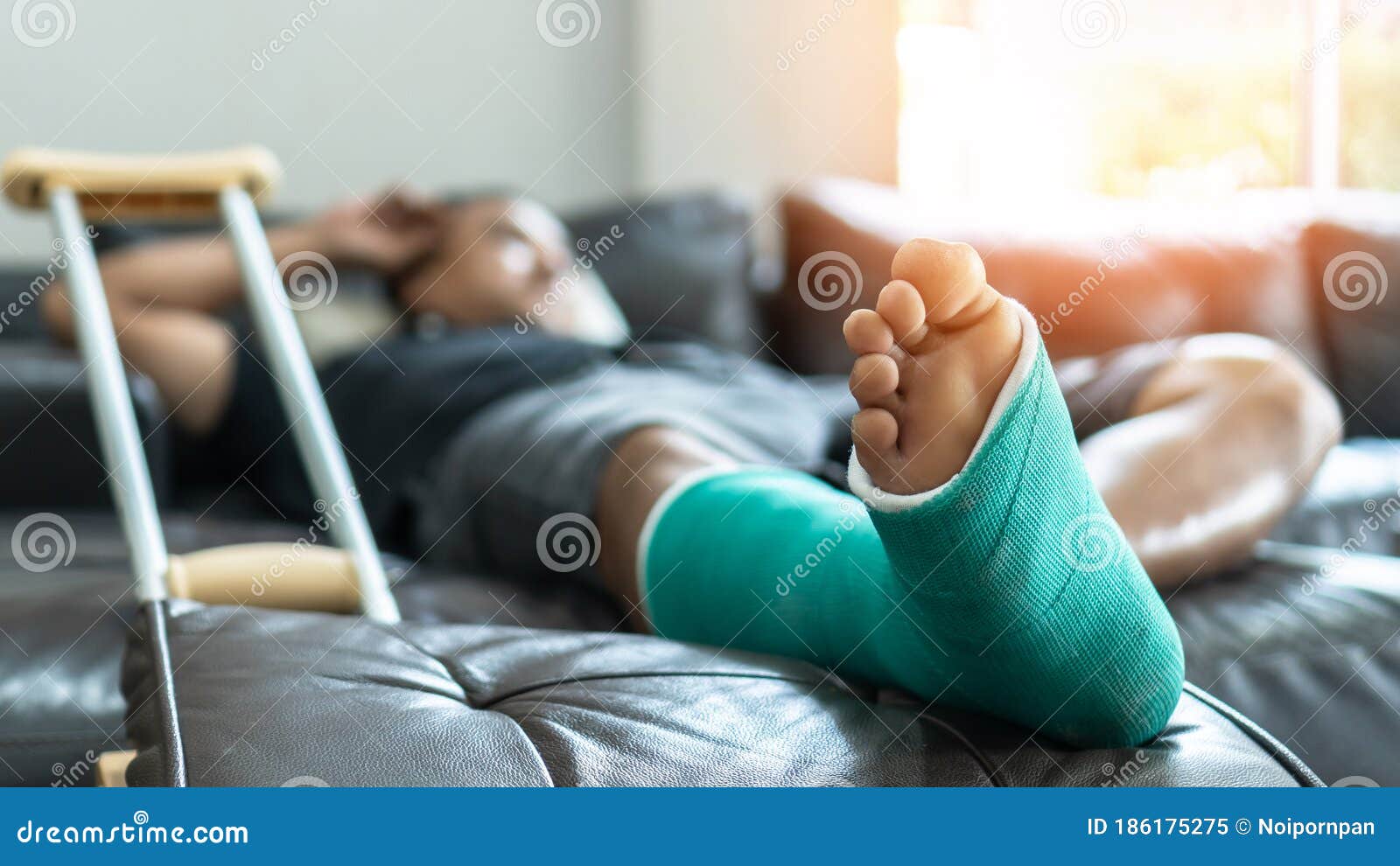 bone fracture foot and leg on male patient with splint cast and crutches during surgery rehabilitation and orthopaedic recovery