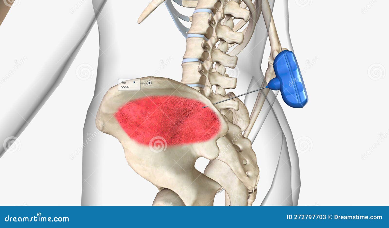 Bone Marrow Aspiration Is A Procedure In Which A Liquid Bone Marrow bone-marrow-aspiration-is-a-procedure-in-which-a-liquid-bone-marrow