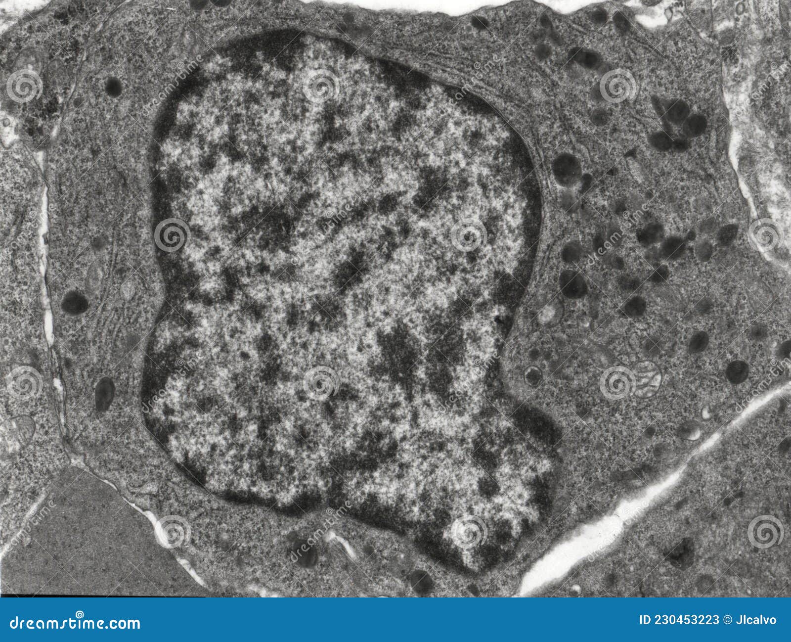 bone marrow. promyelocyte