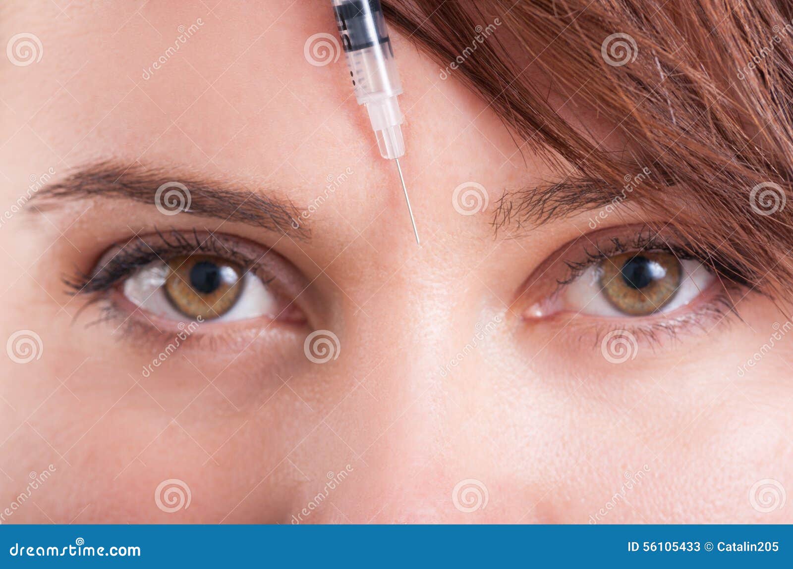 Botox Syringe Needle between Eyes on Forehead Stock Image Image of