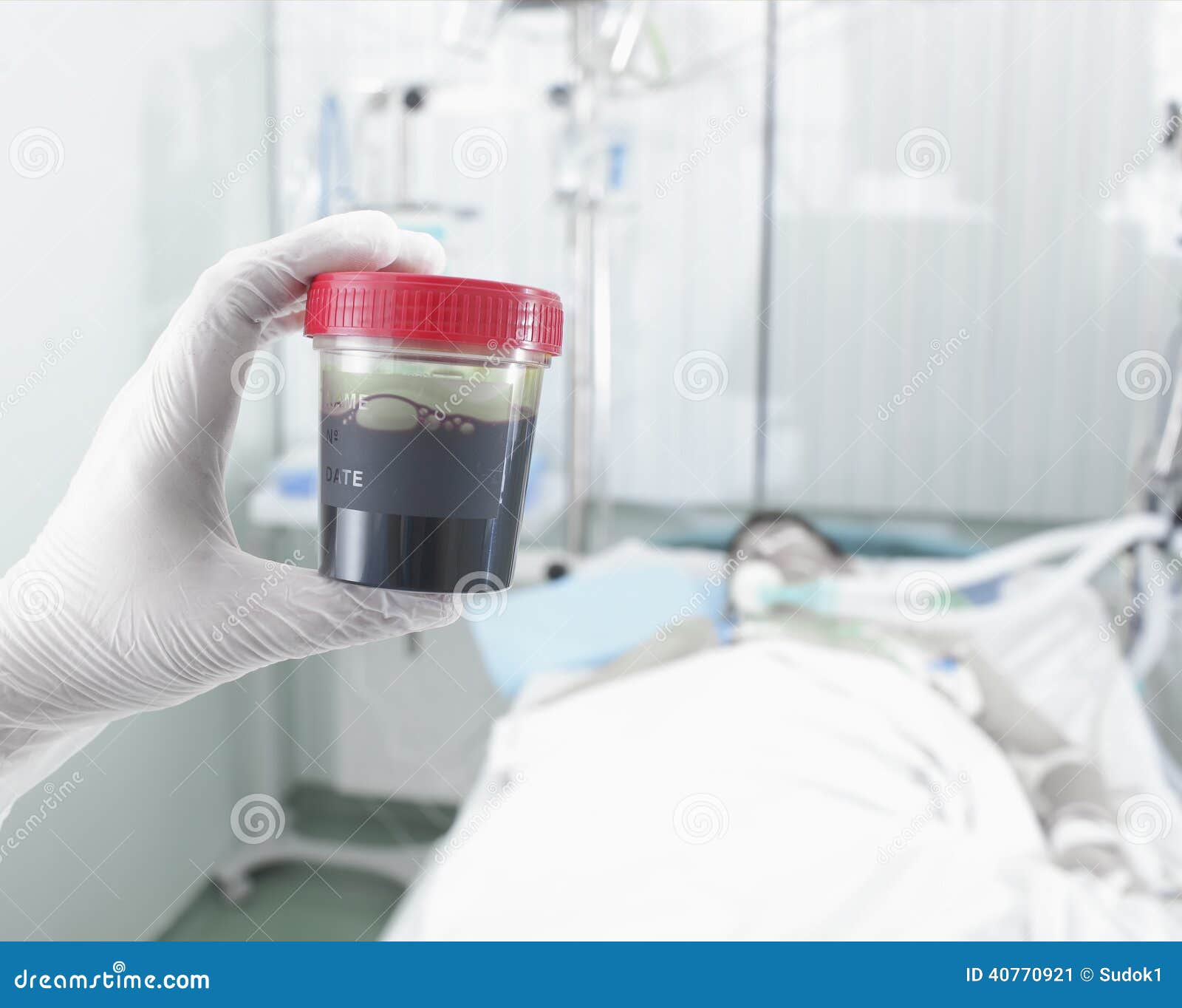 Bottle of Blood Samples are in the Hospital Stock Image Image of