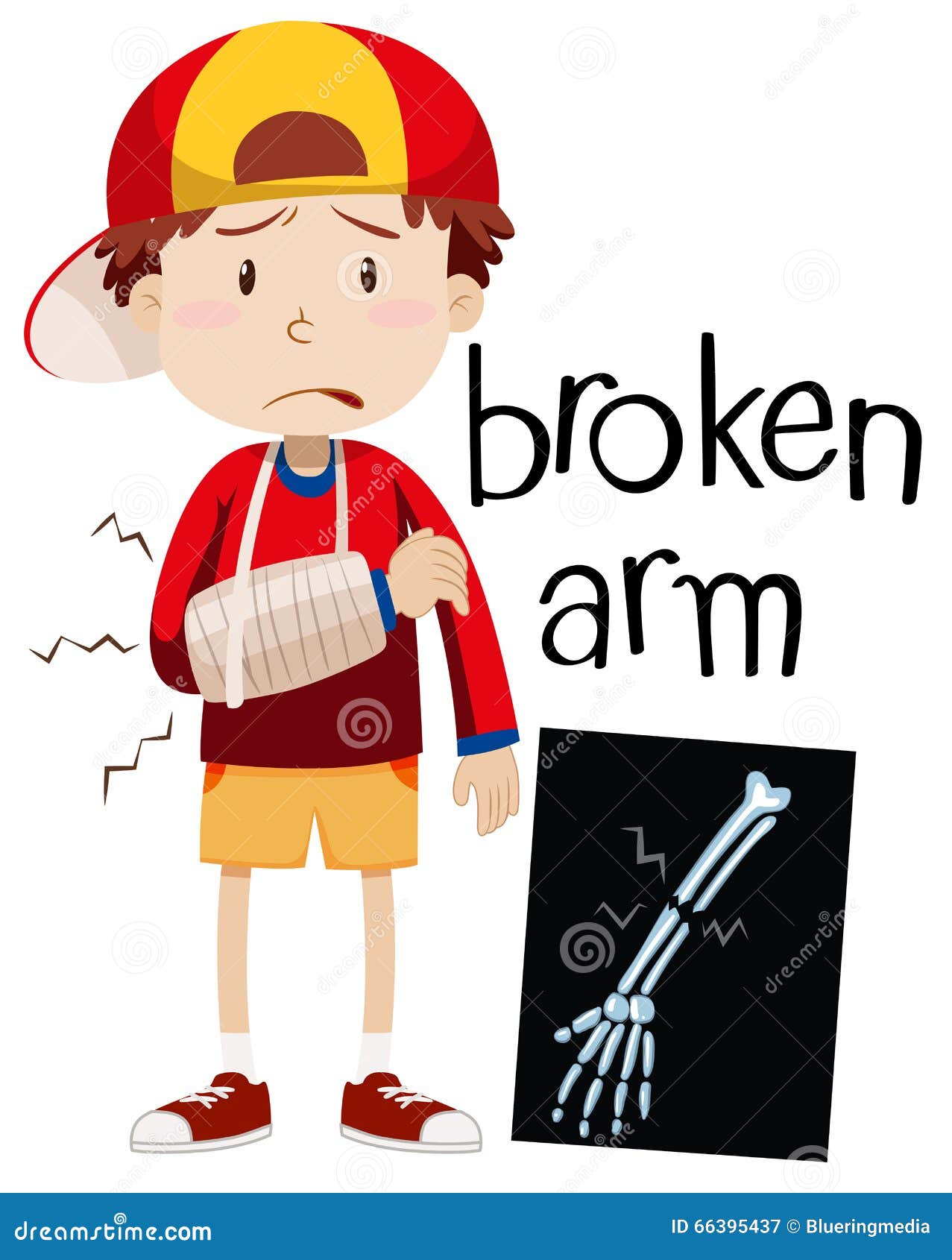 broken bone xray cartoon