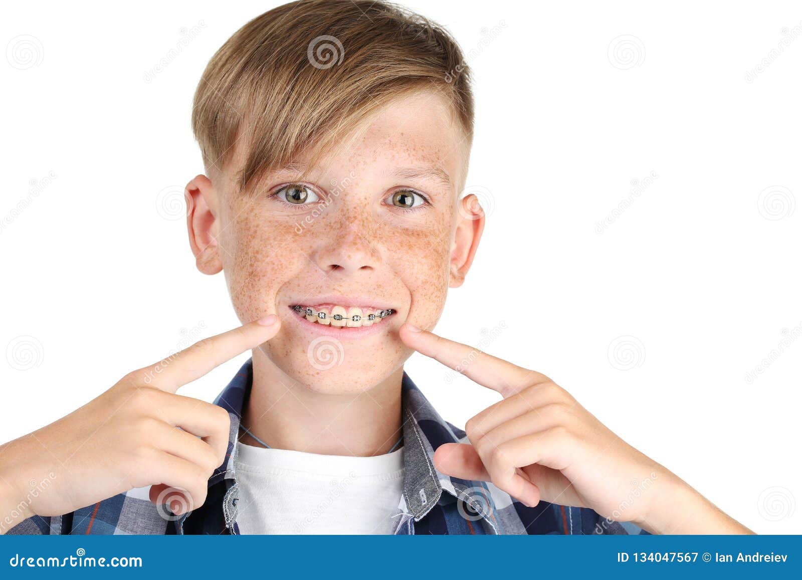 Boy with dental braces stock image. Image of cute, beauty 134047567