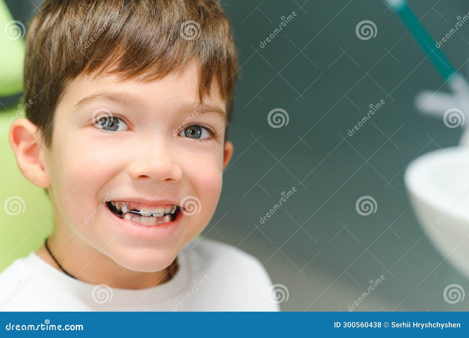The Boy Inserts an Orthodontic Plate in His Mouth Stock Photo Image