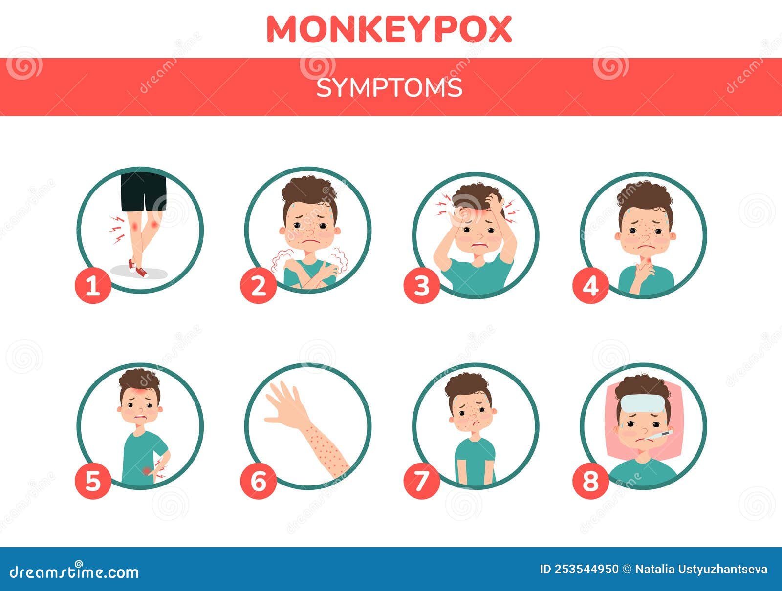 a boy with monkeypox and the symptoms . fever, headache, swollen lymph node, rashes on face,