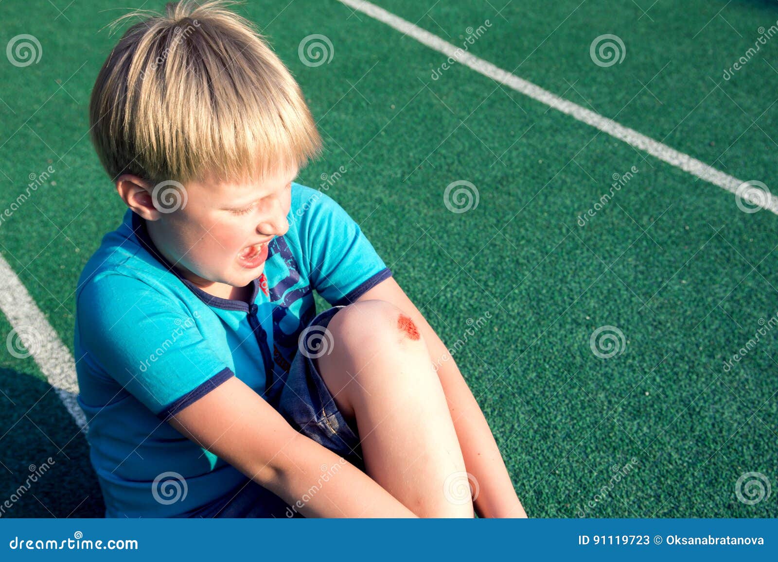 Knee Scrape, Scab, Scar, Injury Closeup Detail RoyaltyFree Stock Image