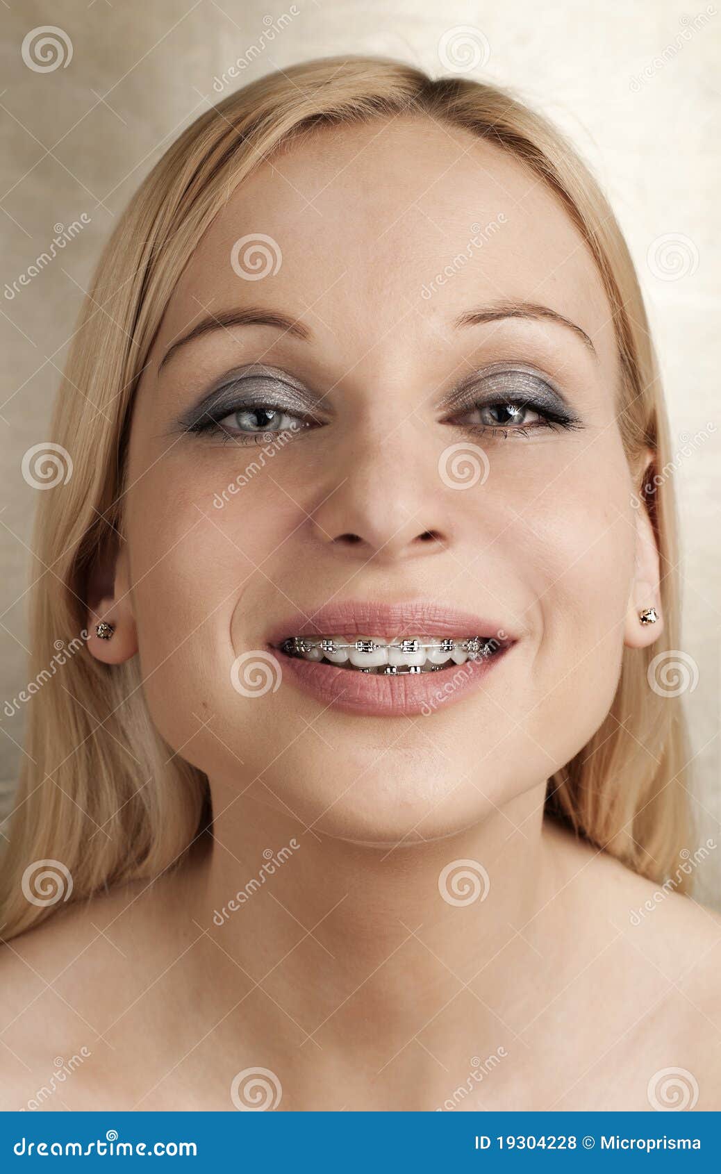 Braces stock photo. Image of people, dental, casual, child - 19304228