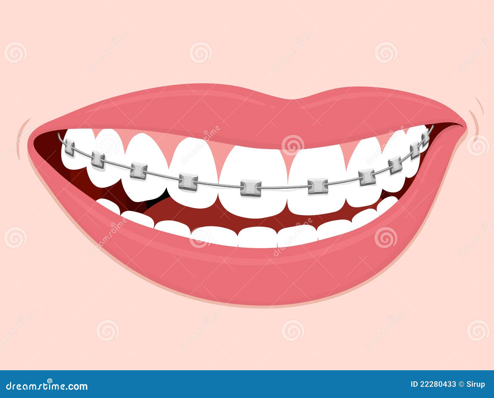 braces corrective orthodontics
