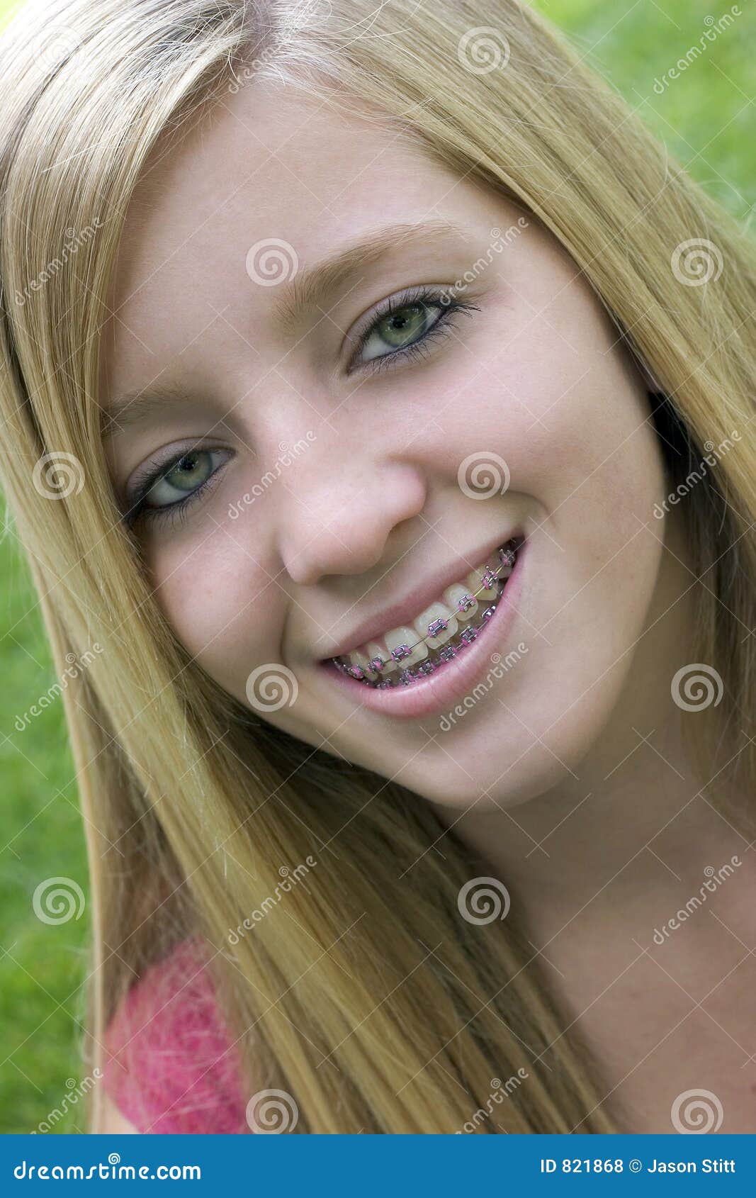 Blonde Teen Braces