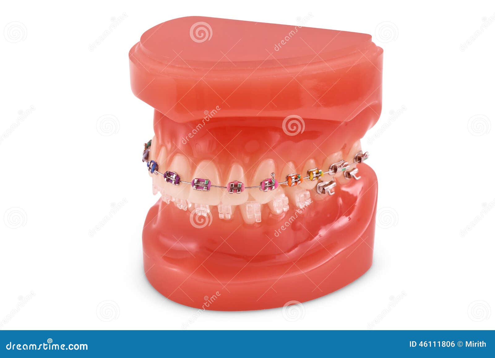 Braces model stock photo. Image of dentistry, medical - 46111806