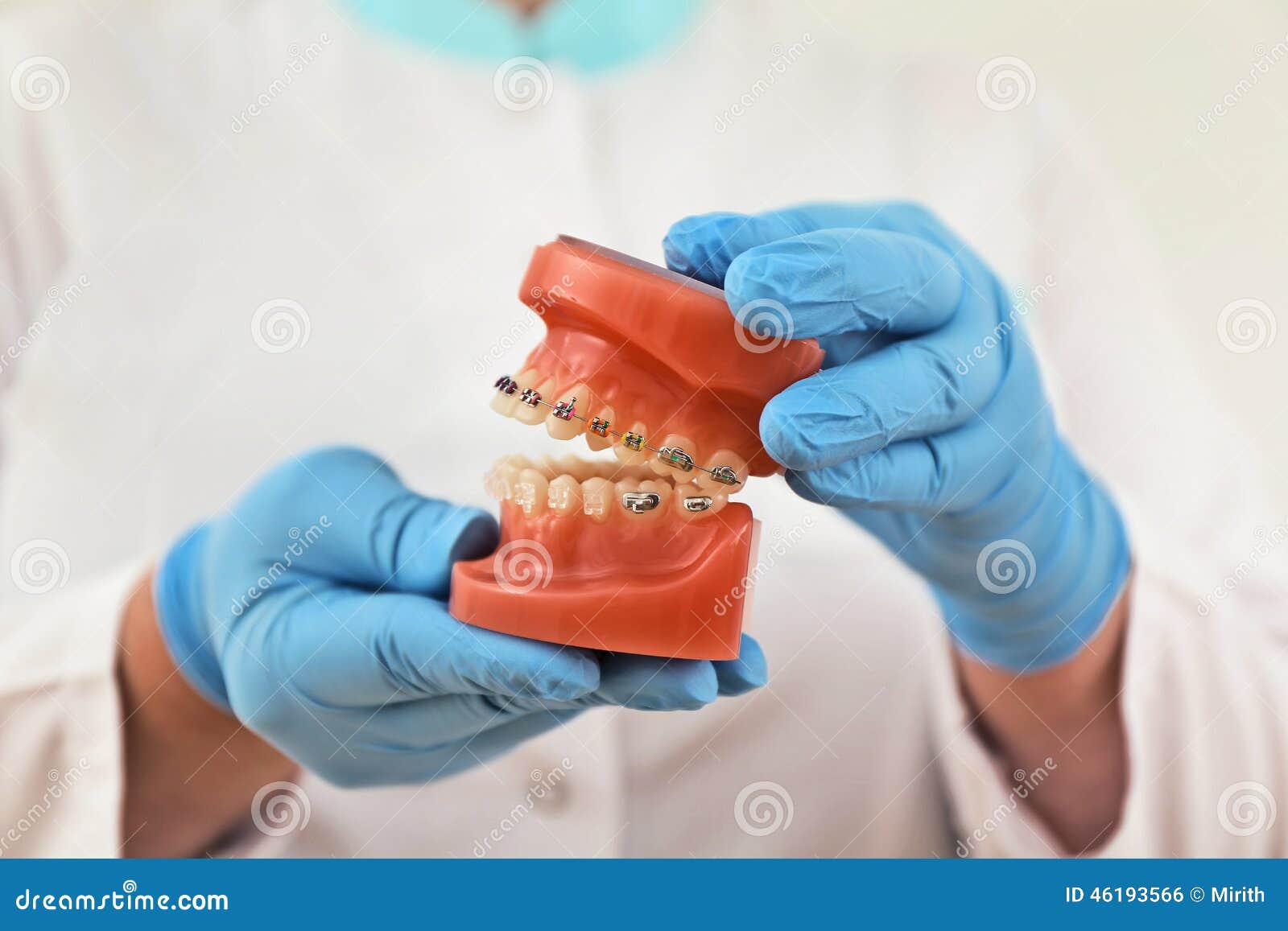 Braces model stock photo. Image of orthodontist, medical 46193566