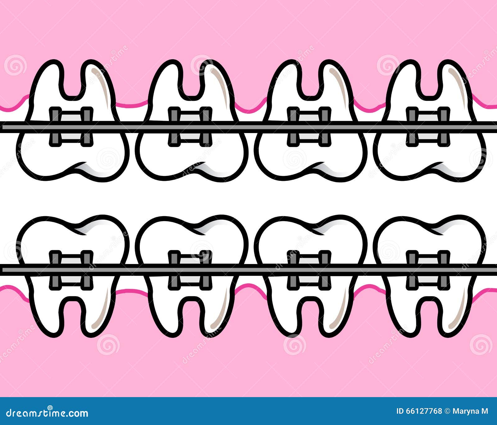 Braces teeth stock vector. Illustration of freshness 66127768