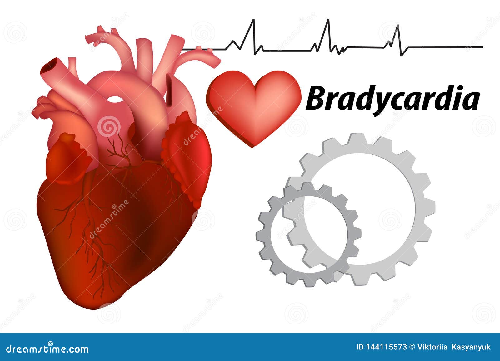 Bradycardia Stock Illustrations 170 Bradycardia Stock Illustrations