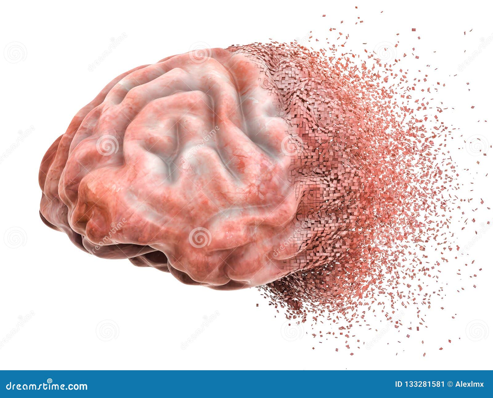 memory loss diseases memory loss diseases