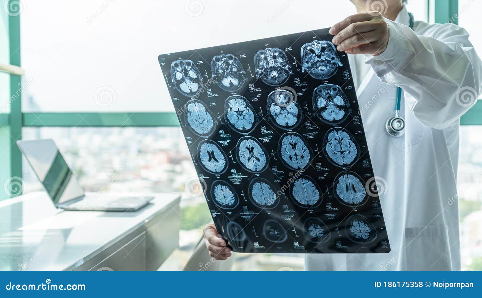 brain disease diagnosis with medical doctor seeing magnetic resonance imaging mri film diagnosing elderly ageing patient