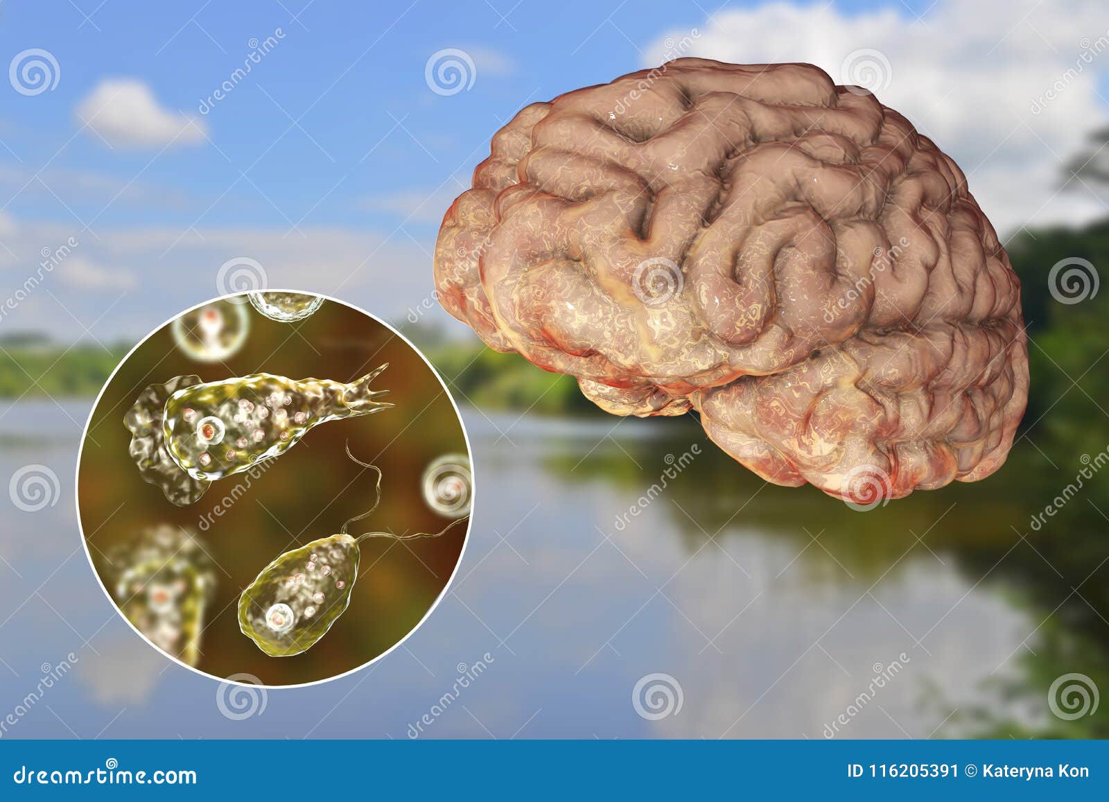 Brain-Eating Amoeba - The Horrific Parasite That Attacks the Human Brain