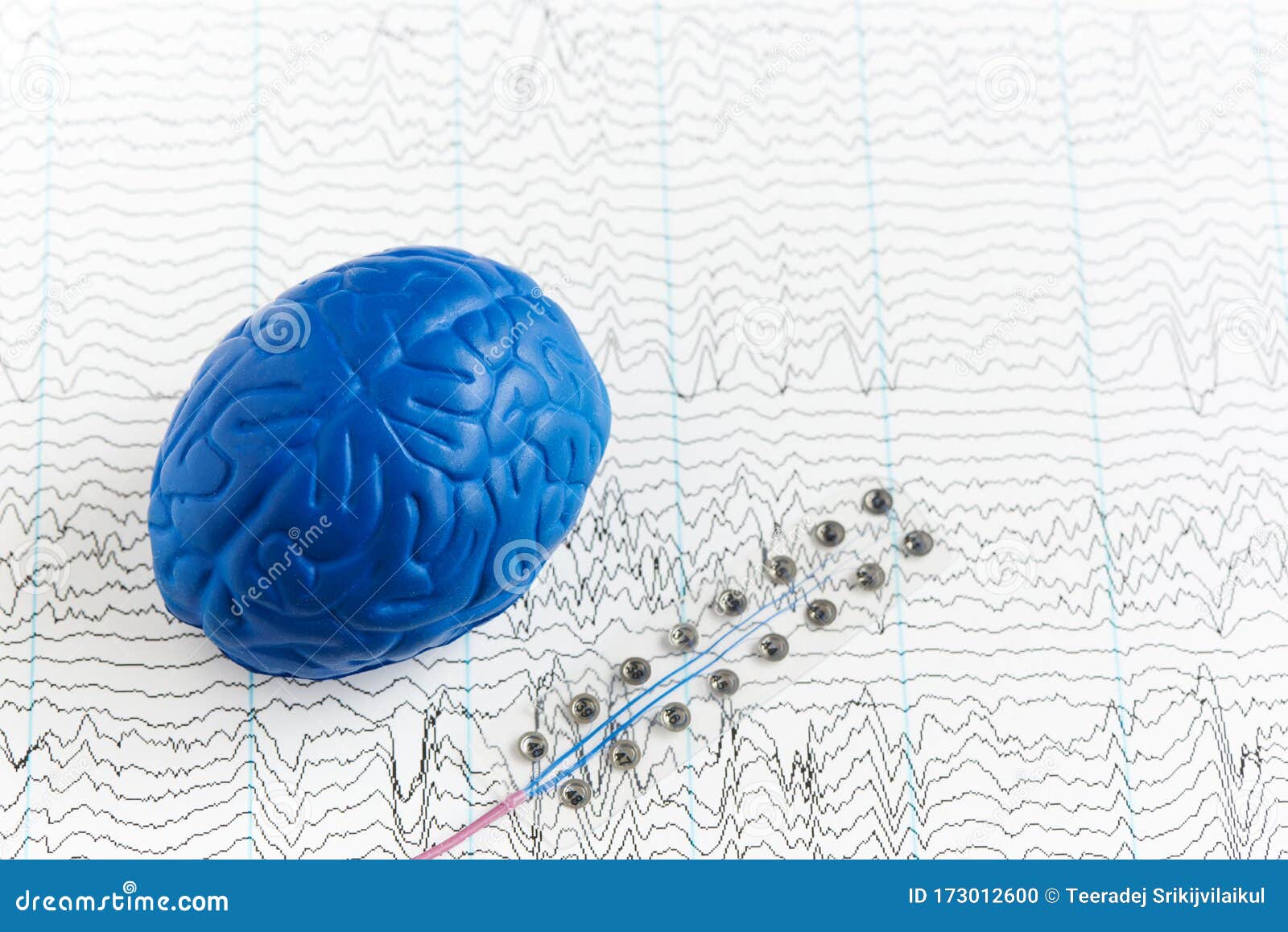 Electrode Recording Brain Waves On EEG Paper Stock Photography ...