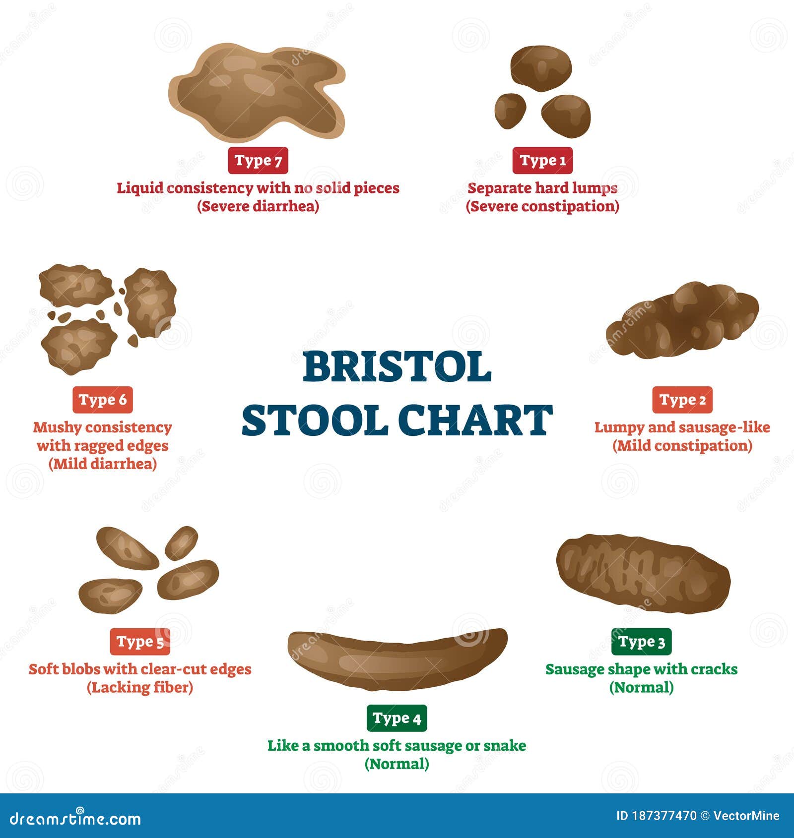 Bristol Stool Chart Tool for Faeces Type Classification Vector