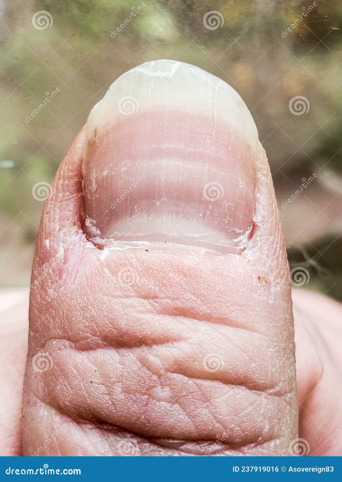 Dry Winter Hands in Need of Manicure. Stock Photo Image of winter