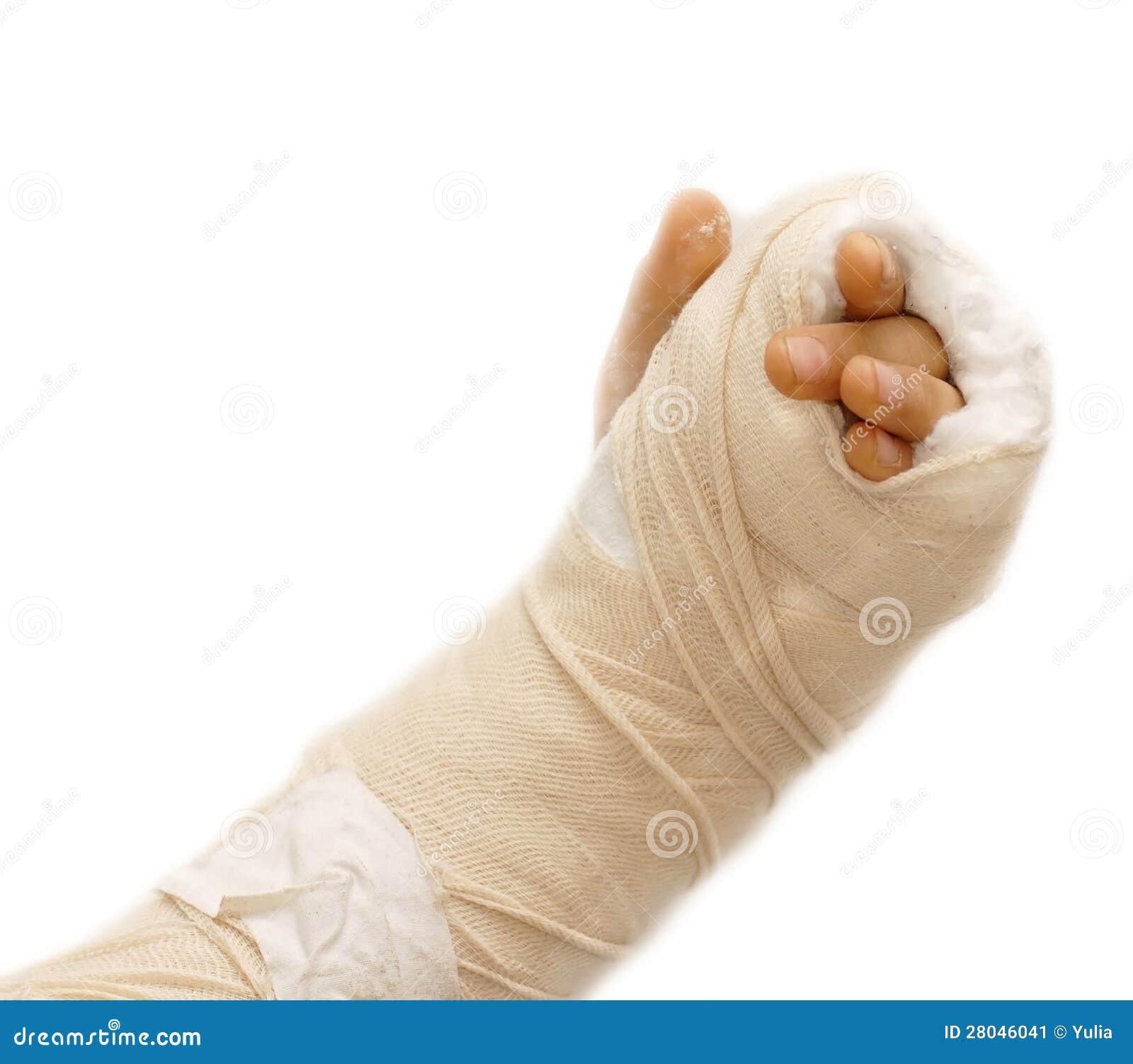 Broken arm stock image. Image of insurance, fracture 28046041