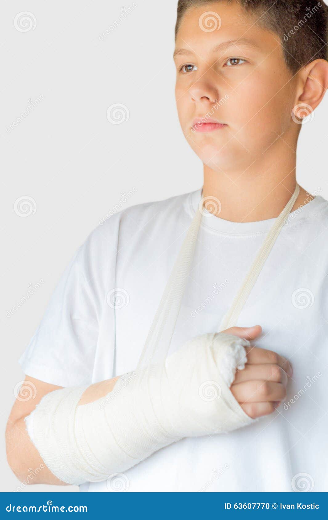 Broken Arm Stock Photo Image 63607770