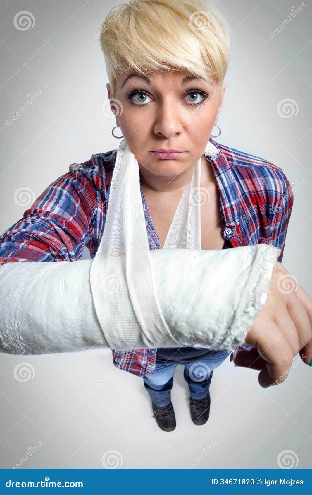 Broken arm stock photo. Image of injured, health, 34671820