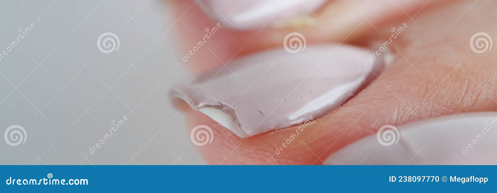 Broken Female Nails with Manicure. Weak and Brittle Nails Stock Photo