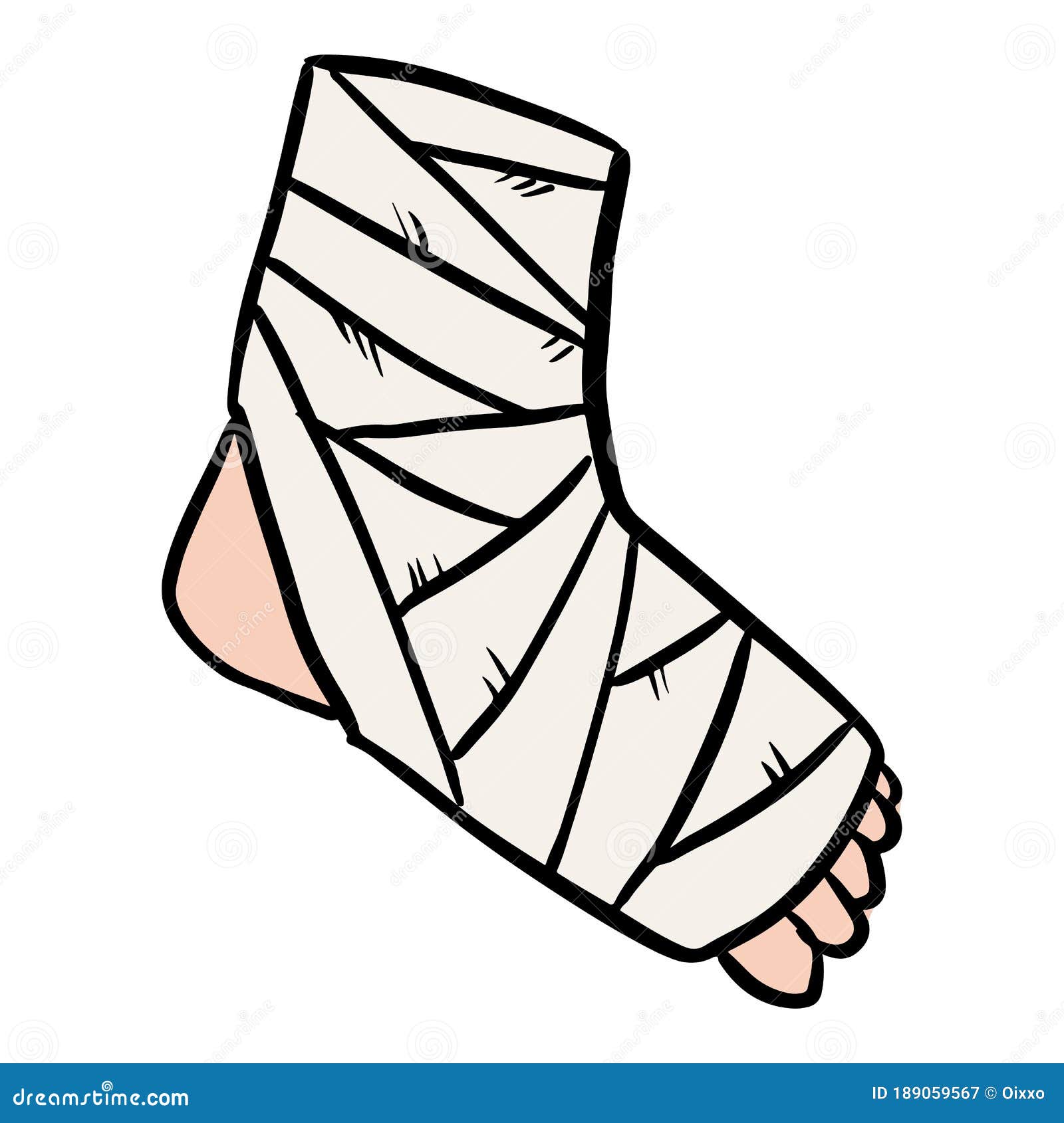 gift bejdsemiddel dukke Broken Leg Cast Doodle. Injured Limb in Gypsum Plaster. Media Glyph Graphic  Symbol Stock Vector - Illustration of graphic, highlights: 189059567