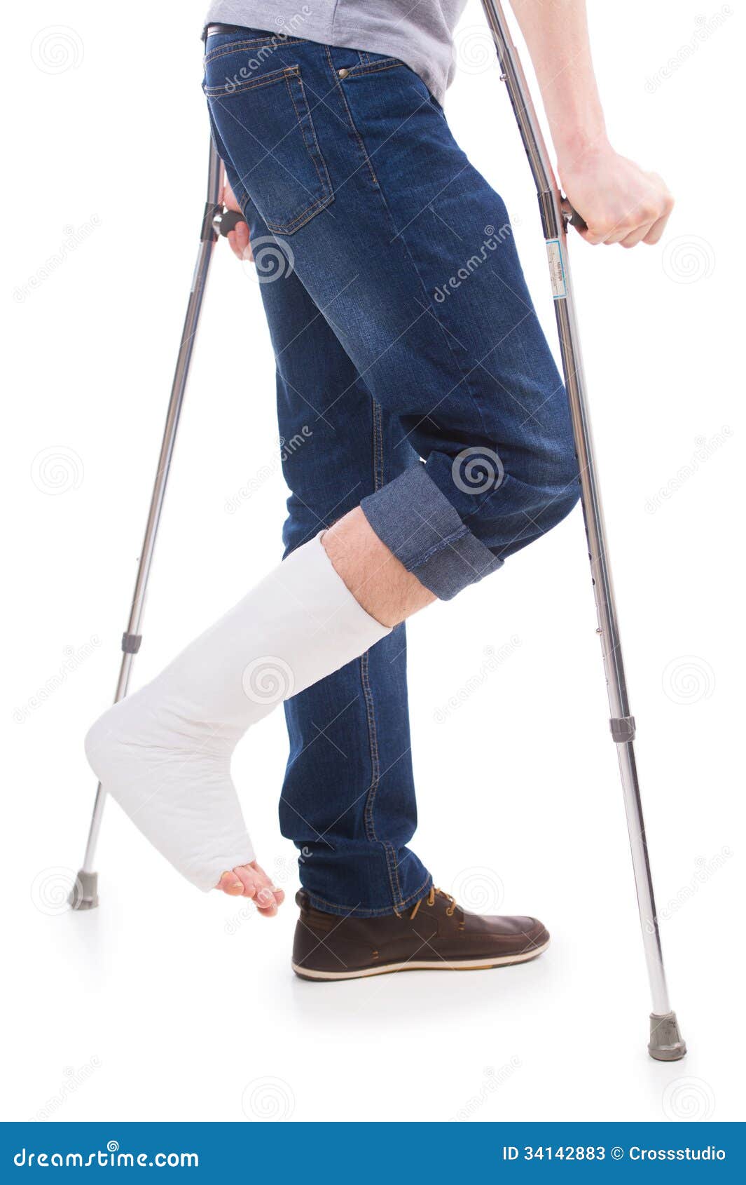 broken leg