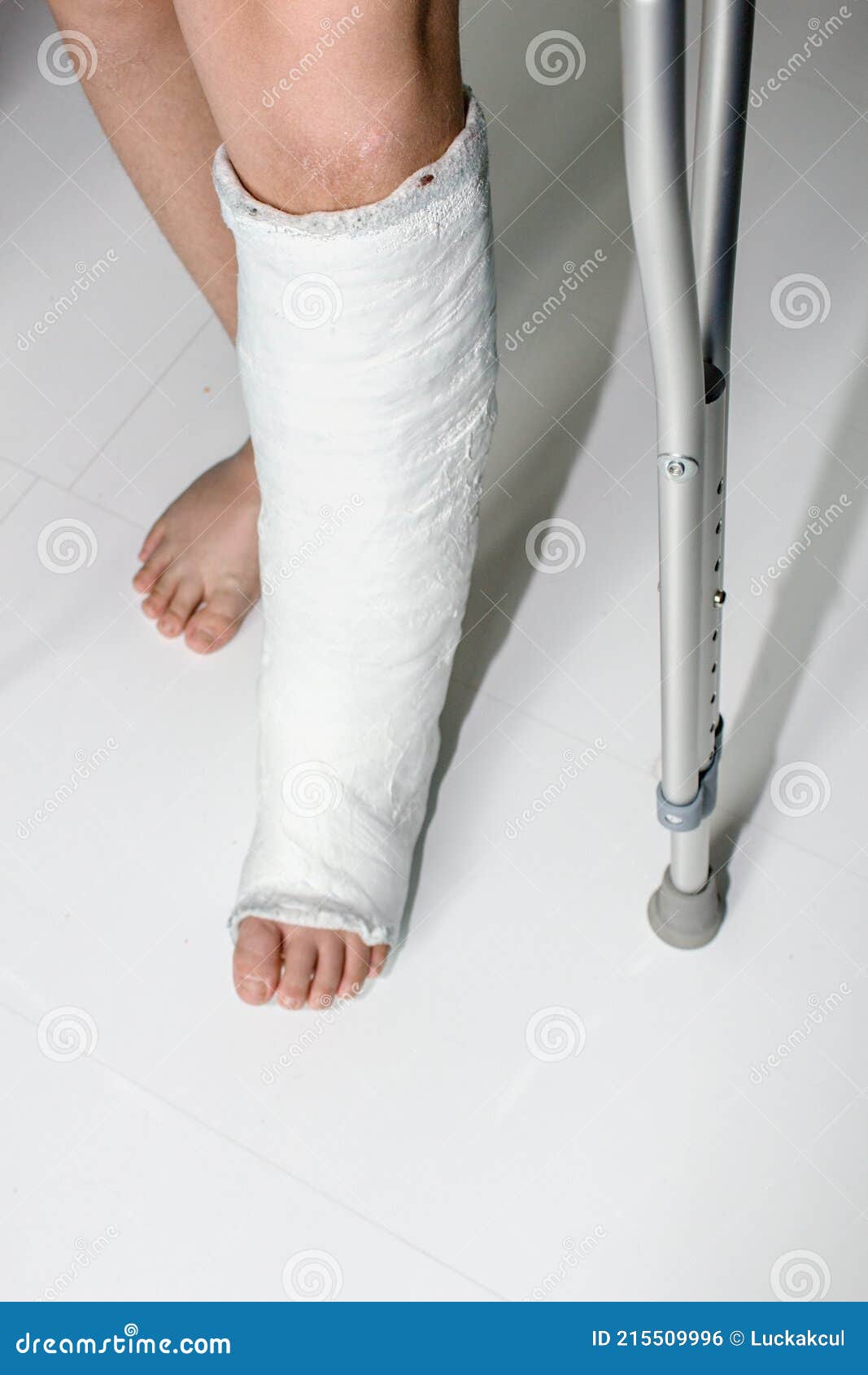 Detail Left Leg or in White Plaster Placed and Crutch. Stock Photo - Image  of fracture, adhesion: 215509996