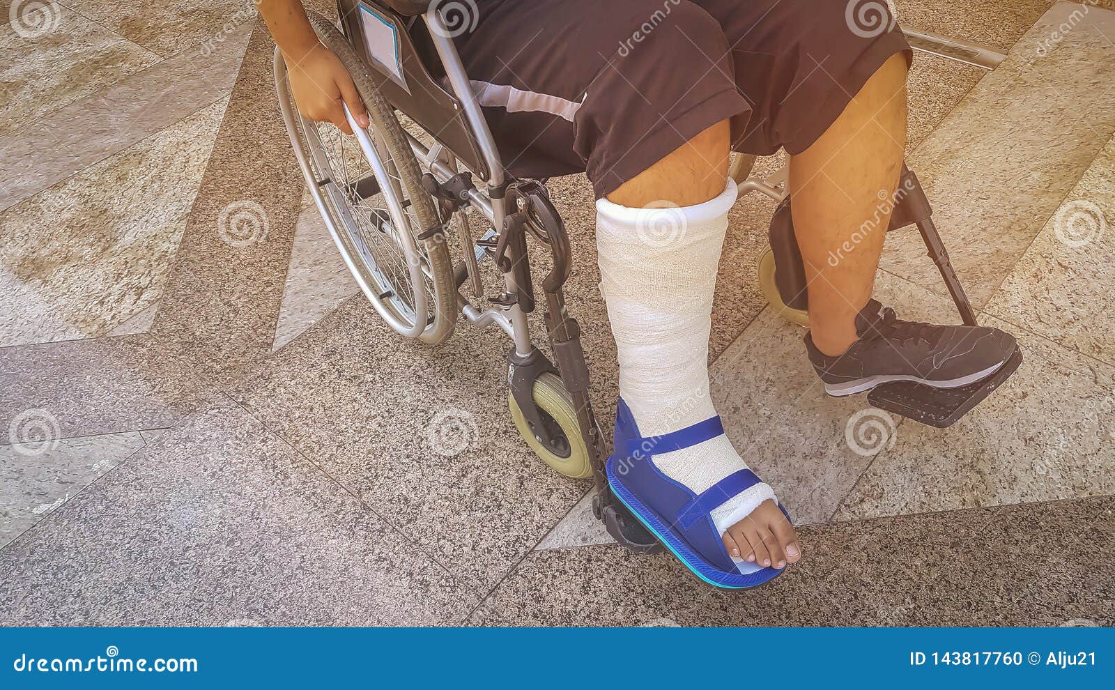 Инвалидная коляска для перелома ноги
