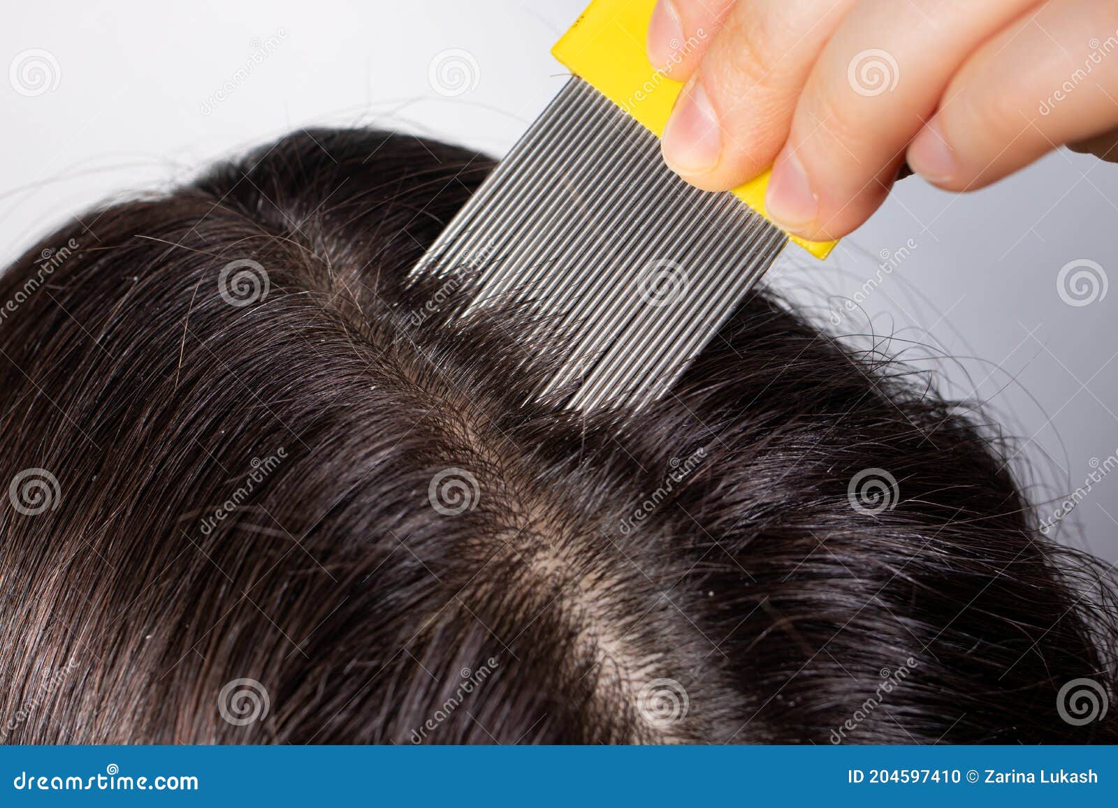 A Brunette Woman with Pediculosis Cleans Her Hair from Lice and Nits with a  Comb with Small Prongs. a Lice Comb Stock Photo - Image of beauty, hand:  204597410