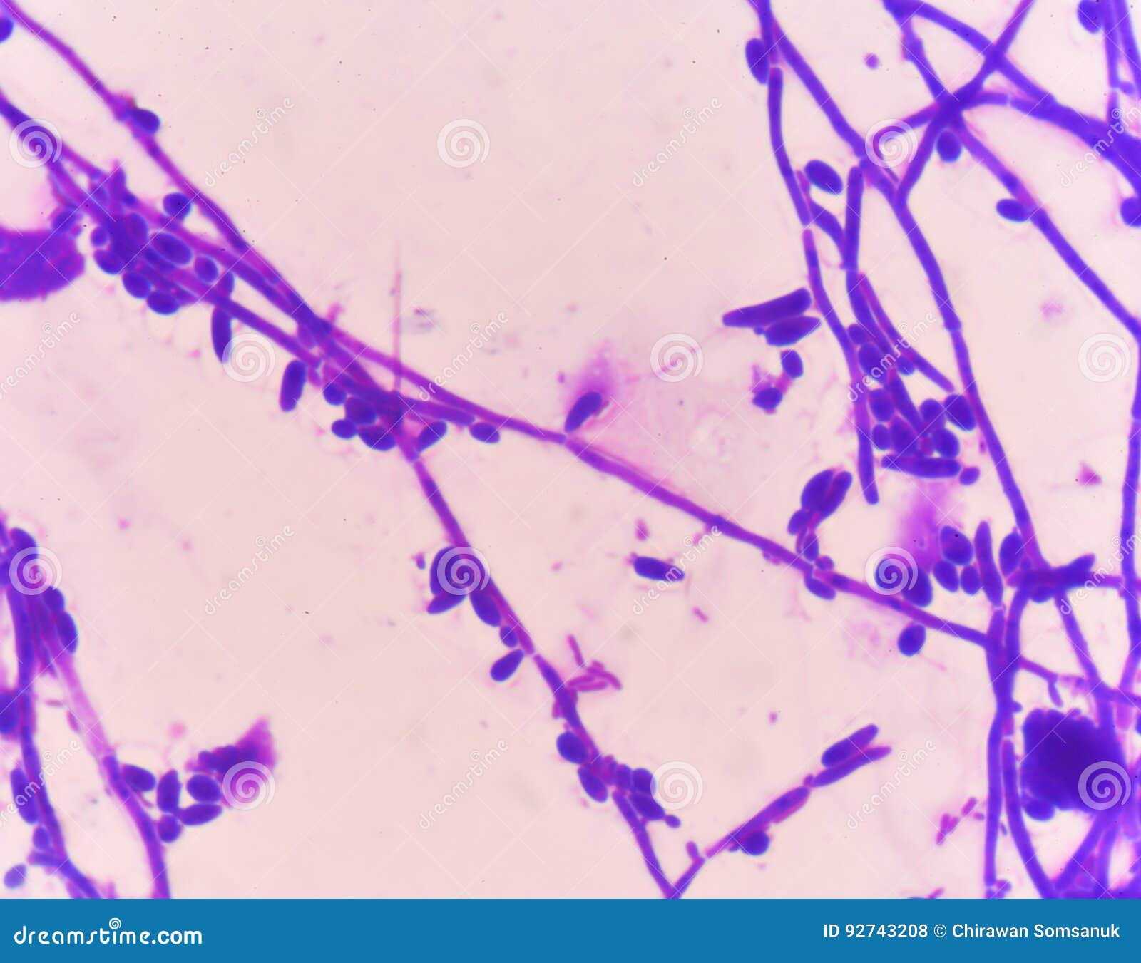 budding yeast gram stain