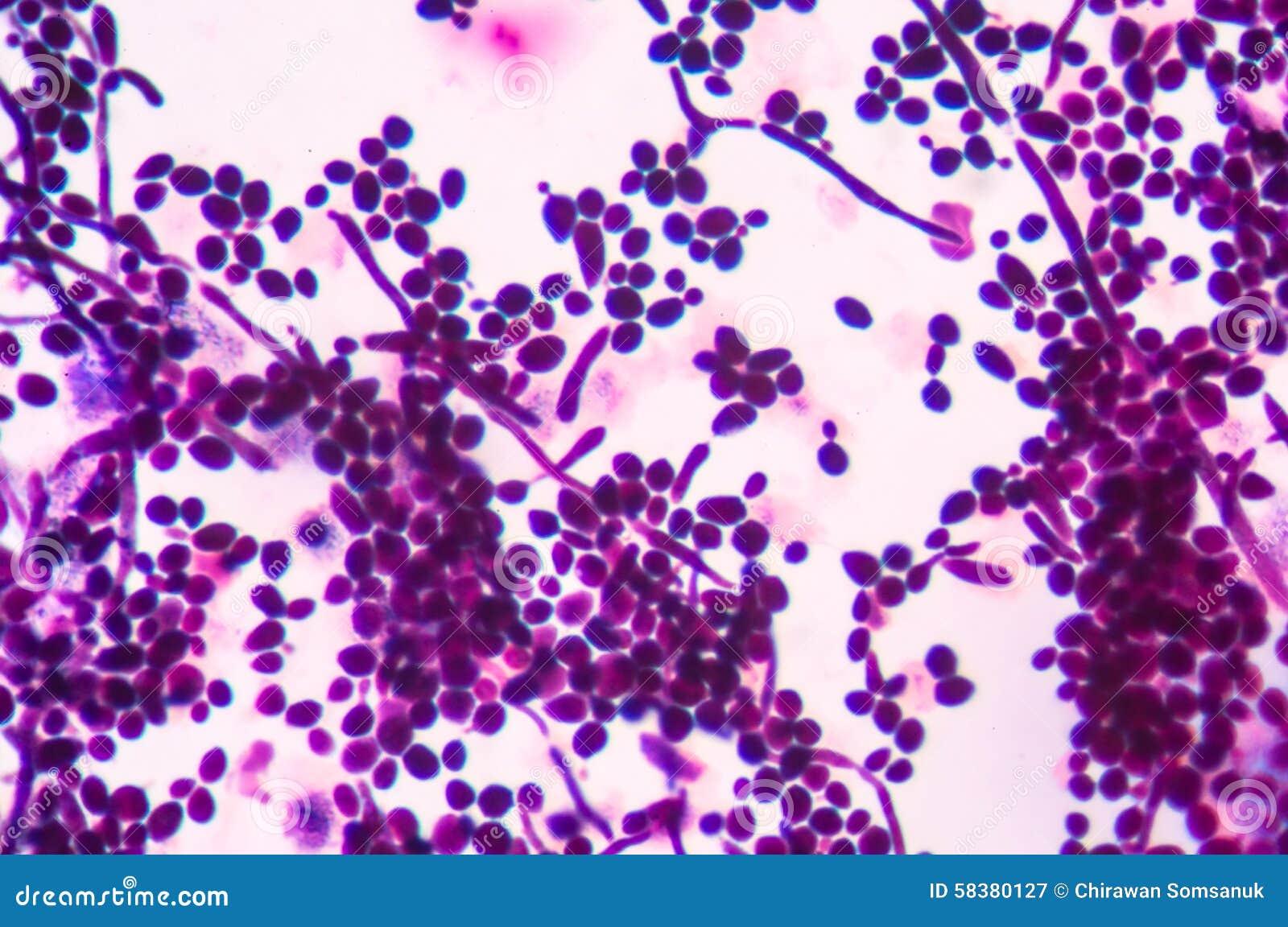 Budding Yeast Cells With Pseudohyphae Stock Photo - Image: 58380127