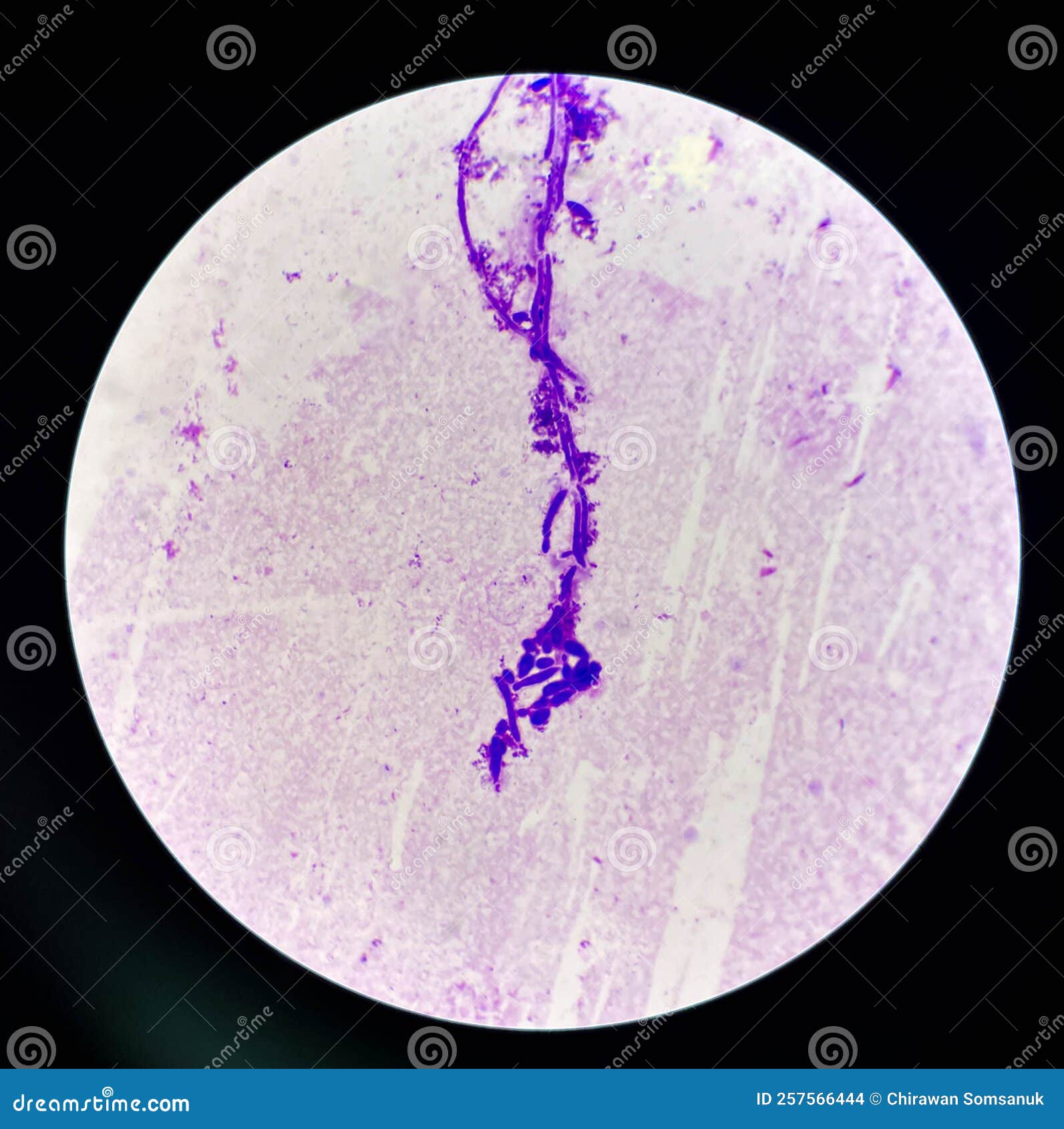 Budding Yeast Cells with Pseudohyphae in Urine Sample on Wright Gimsa