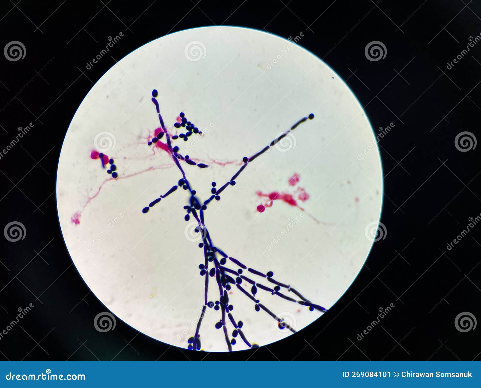 Budding Yeast with Pseudo Hephae in Urine Stock Image Image of