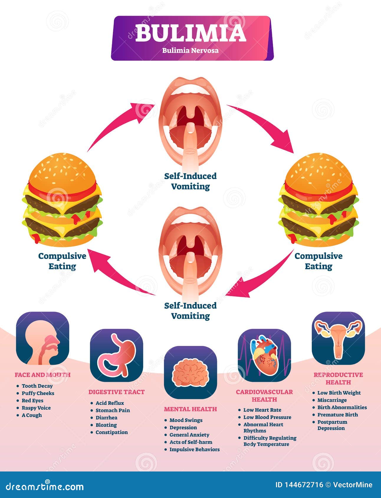 bulimia  . labeled self induced vomiting diagnosis scheme