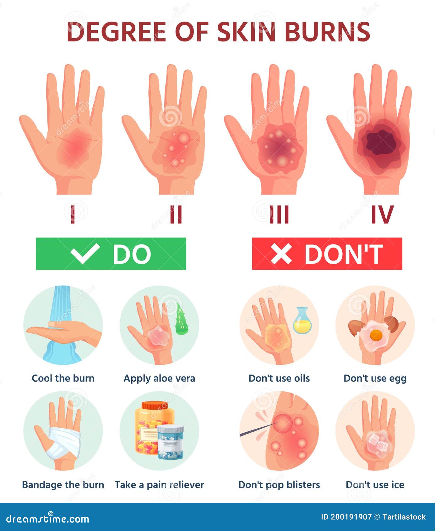 burns degree. first aid for burn wound. fire damage to skin classification. hand blisters.  infographic treatment