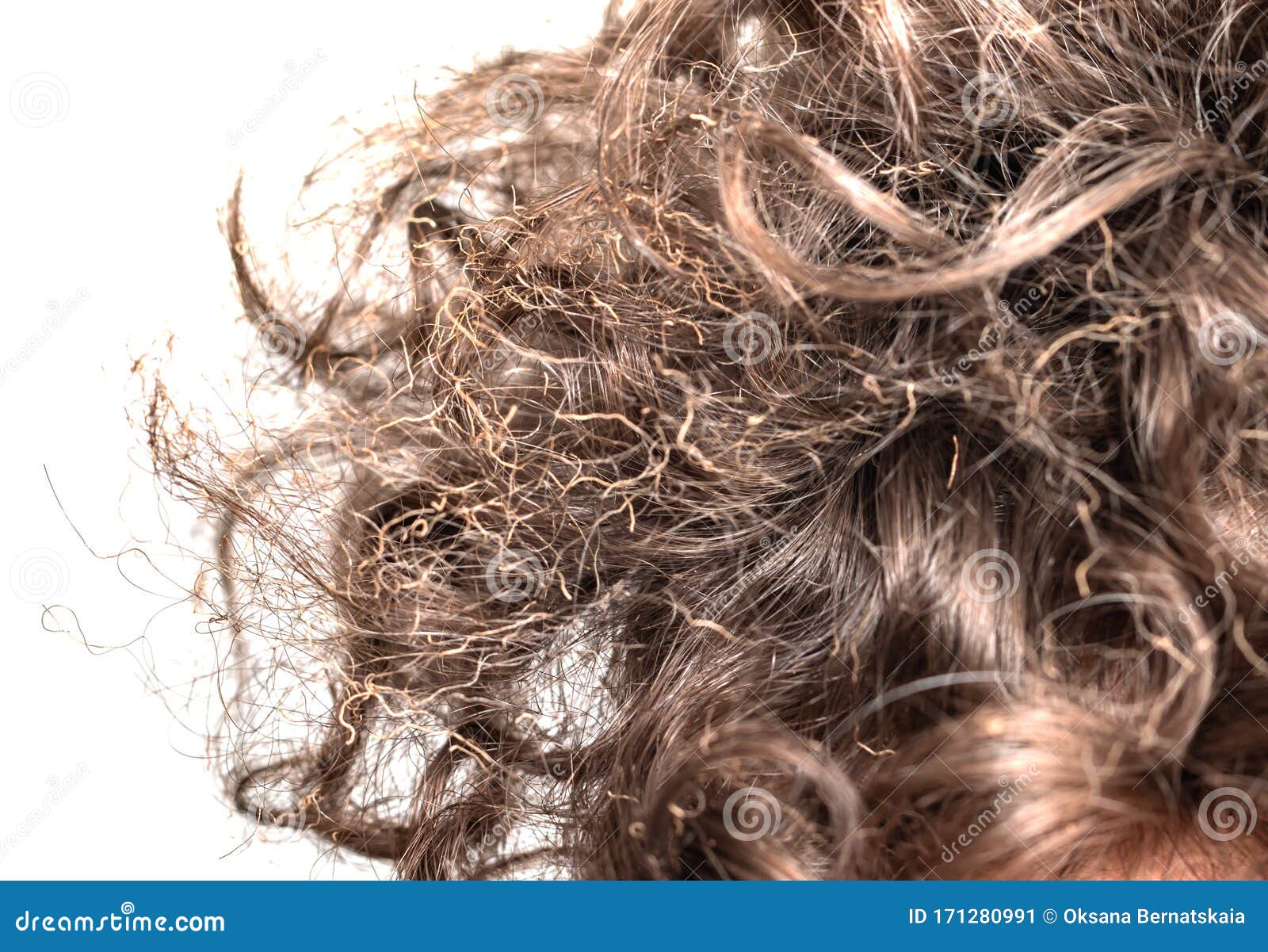 Burnt hair on his head stock image. Image of contrast - 171280991 Burnt hair on his head stock image. Image of contrast - 171280991