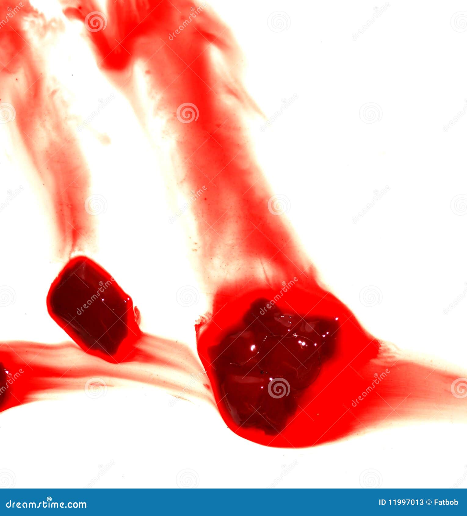 Caillots De Sang Illustration Stock Illustration Du Souillure
