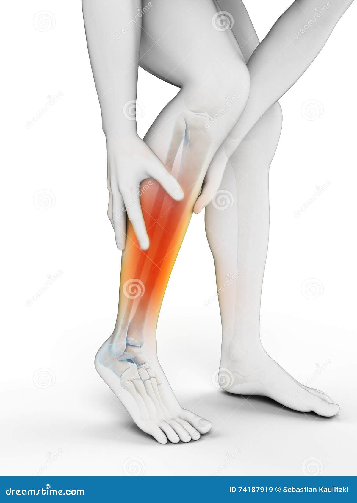 Calf pain stock illustration. Illustration of calf, medical 74187919