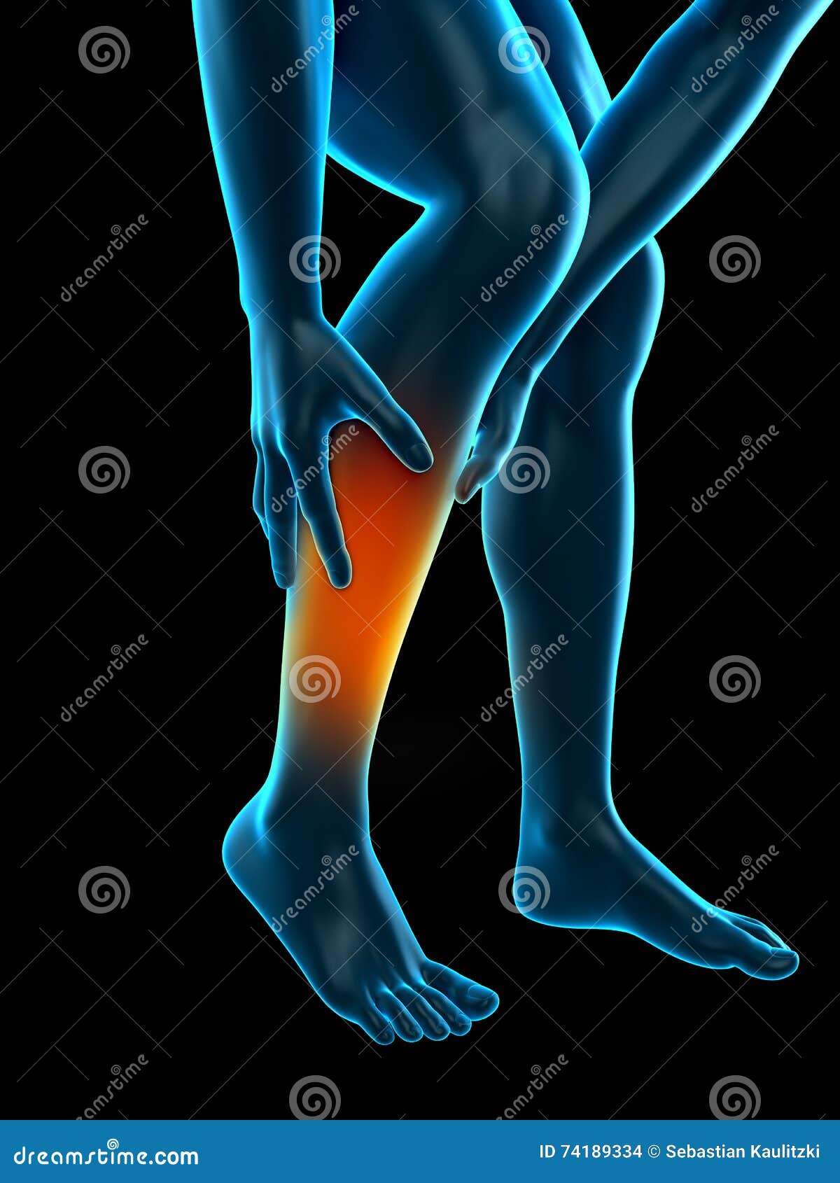 Calf pain stock illustration. Illustration of medically 74189334