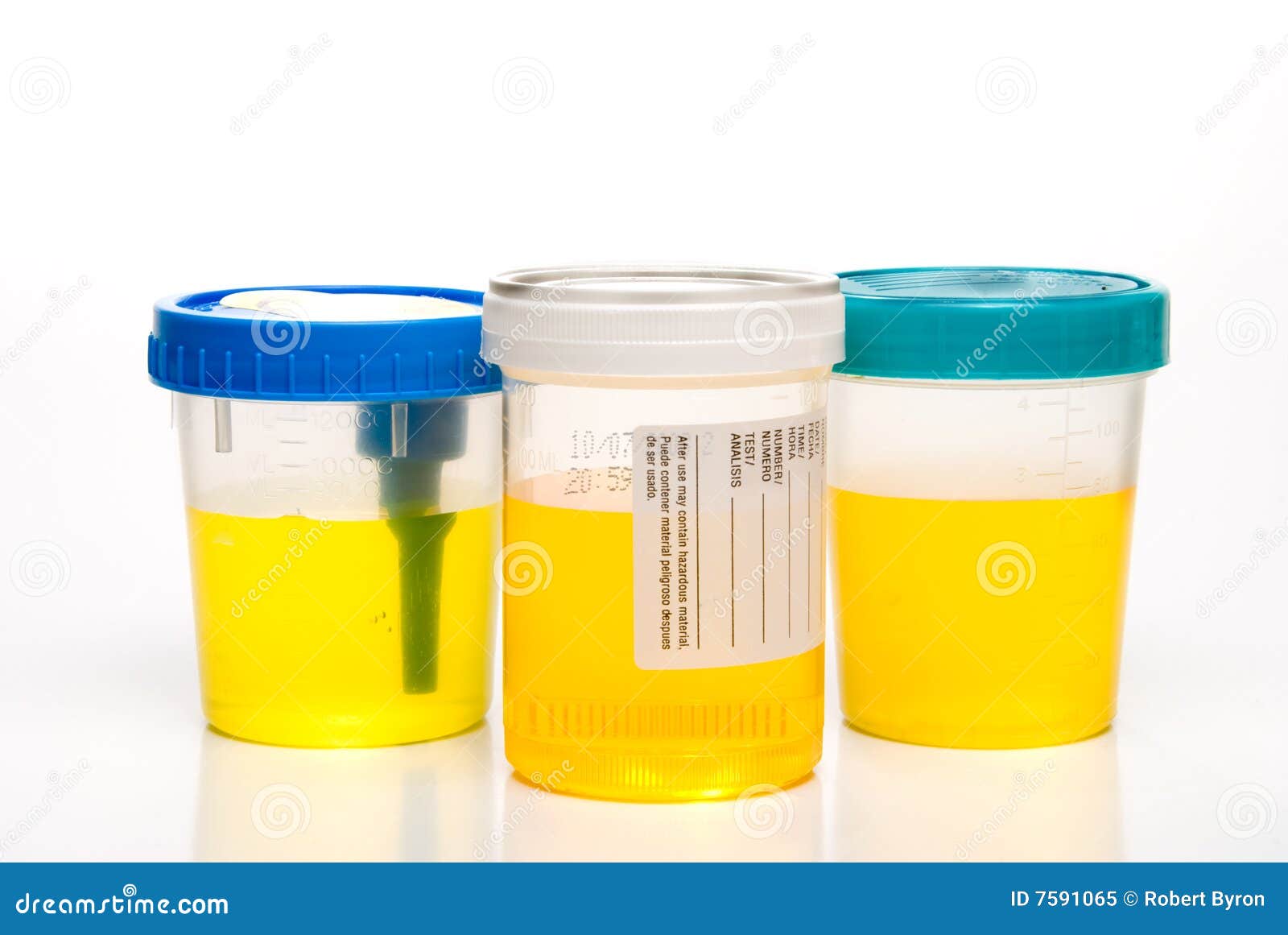 Campione Di Urina Con Sangue. Immagine Stock - Immagine Di Pipi, Anima - Foto 3