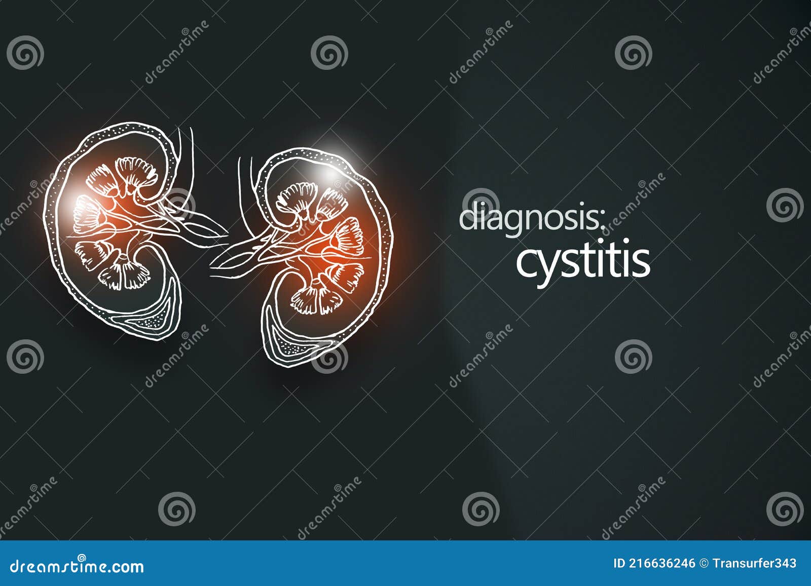 cancer kidney disease or renal cell carcinomas. malignant kidney tumors.