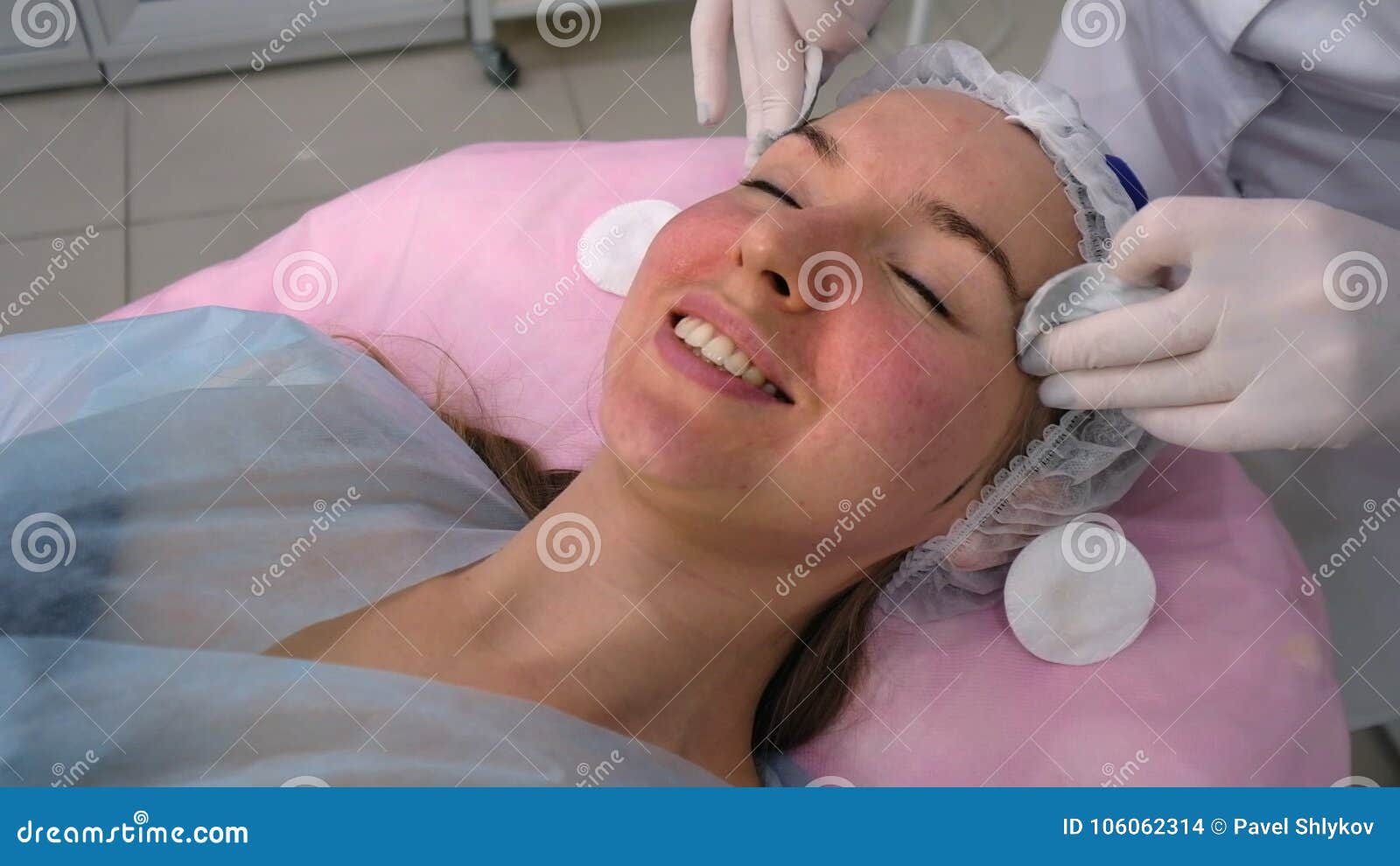 face peeling side effects face peeling side effects