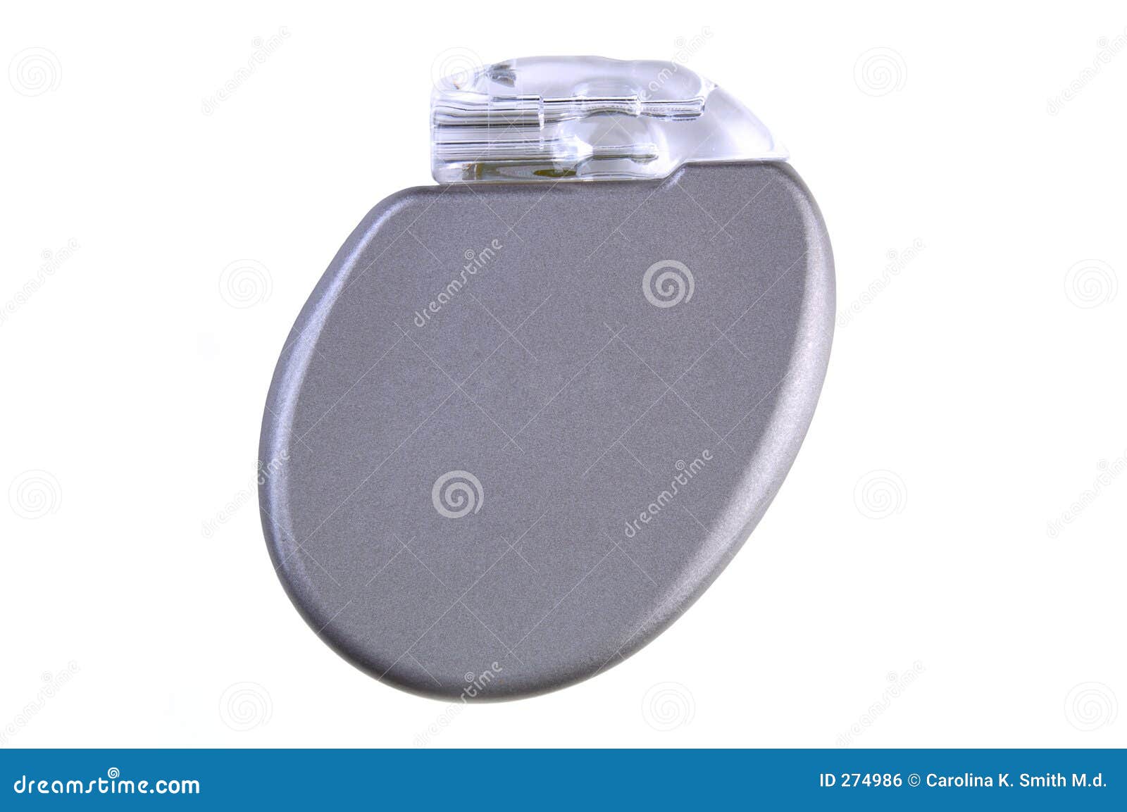 An Implantable Cardioverter Defibrillator Or ICD Pacemaker With Leads