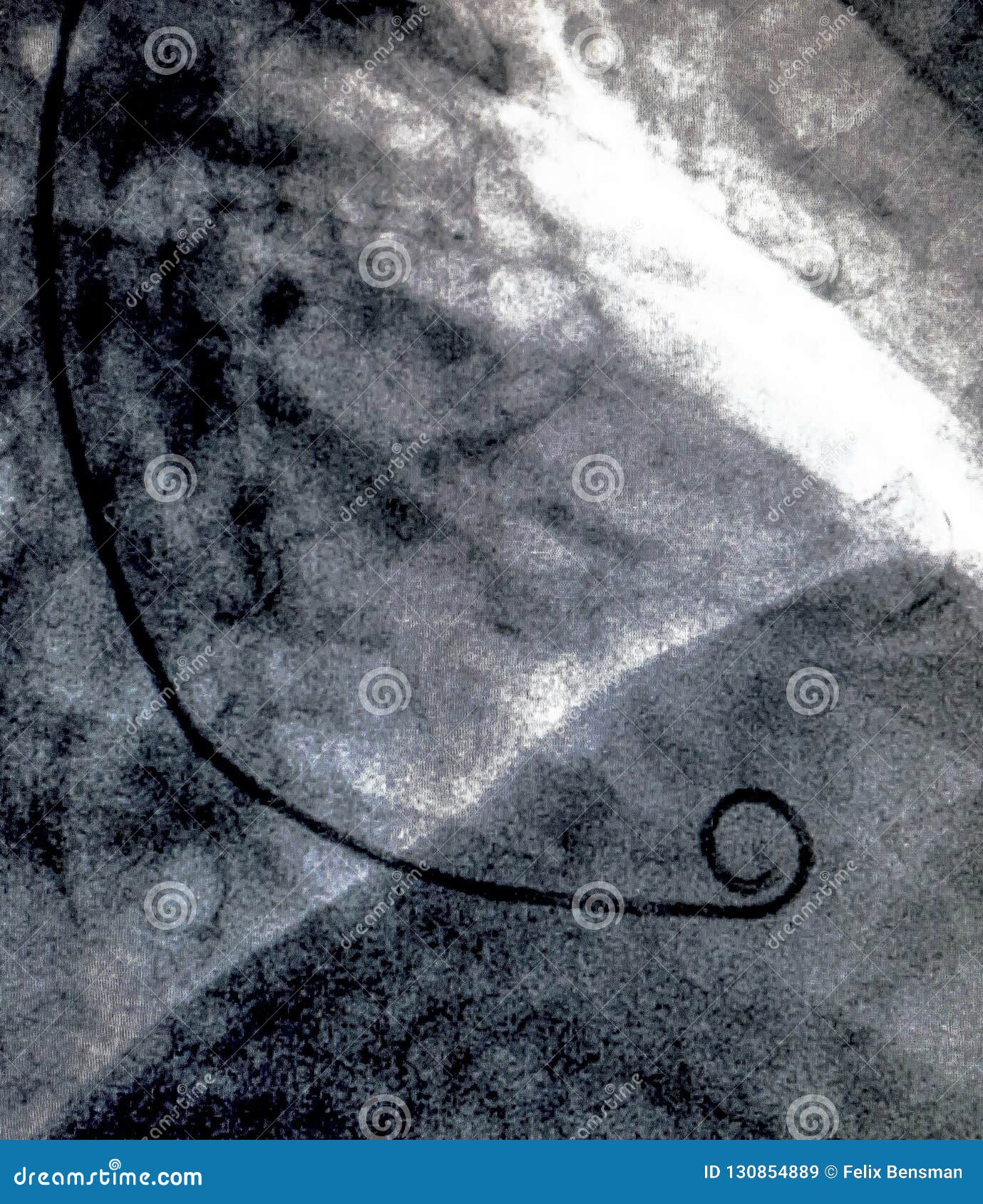 cardiac ventriculography. catheterization